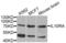 Interleukin 10 Receptor Subunit Alpha antibody, LS-C331715, Lifespan Biosciences, Western Blot image 