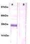 Cyclin Dependent Kinase Inhibitor 1B antibody, TA354222, Origene, Western Blot image 