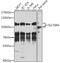 Solute Carrier Family 39 Member 6 antibody, GTX33505, GeneTex, Western Blot image 