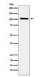 DExD/H-Box Helicase 58 antibody, M00244, Boster Biological Technology, Western Blot image 