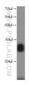 Regulator Of G Protein Signaling 17 antibody, 12549-1-AP, Proteintech Group, Western Blot image 