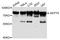 Septin 9 antibody, LS-B14300, Lifespan Biosciences, Western Blot image 