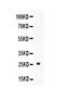 Triggering Receptor Expressed On Myeloid Cells 1 antibody, A02135-1, Boster Biological Technology, Western Blot image 