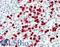 S100 Calcium Binding Protein A12 antibody, LS-B15402, Lifespan Biosciences, Immunohistochemistry paraffin image 