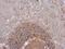 NADH:Ubiquinone Oxidoreductase Subunit B5 antibody, NBP1-31684, Novus Biologicals, Immunohistochemistry frozen image 