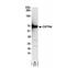 Cleavage Stimulation Factor Subunit 2 antibody, NB100-57531, Novus Biologicals, Western Blot image 