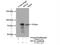 Metastasis Associated 1 Family Member 2 antibody, 17554-1-AP, Proteintech Group, Immunoprecipitation image 