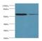 3-Oxoacid CoA-Transferase 1 antibody, LS-C376256, Lifespan Biosciences, Western Blot image 