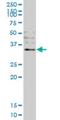 OTU Deubiquitinase, Ubiquitin Aldehyde Binding 1 antibody, H00055611-M09, Novus Biologicals, Western Blot image 