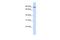 OTU Deubiquitinase 7B antibody, A04857, Boster Biological Technology, Western Blot image 