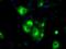 GDH antibody, MA5-25125, Invitrogen Antibodies, Immunocytochemistry image 