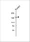 Ovostatin homolog 1 antibody, A18488, Boster Biological Technology, Western Blot image 