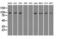 Neurotrophic Receptor Tyrosine Kinase 3 antibody, GTX83976, GeneTex, Western Blot image 