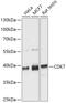 Cyclin Dependent Kinase 7 antibody, 14-712, ProSci, Western Blot image 