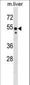 SRC Proto-Oncogene, Non-Receptor Tyrosine Kinase antibody, LS-C158263, Lifespan Biosciences, Western Blot image 