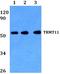 TRNA Methyltransferase 11 Homolog antibody, A15724-1, Boster Biological Technology, Western Blot image 