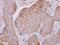 Dynactin Subunit 4 antibody, PA5-30617, Invitrogen Antibodies, Immunohistochemistry paraffin image 