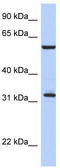 Ubiquitin-conjugating enzyme E2 R1 antibody, TA330370, Origene, Western Blot image 