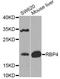 Retinol Binding Protein 4 antibody, A12495, ABclonal Technology, Western Blot image 