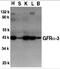 GDNF Family Receptor Alpha 3 antibody, 1137, ProSci Inc, Western Blot image 