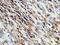 Actin Alpha 2, Smooth Muscle antibody, MAB1420, R&D Systems, Immunohistochemistry frozen image 