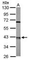 Actin Related Protein 2 antibody, GTX115936, GeneTex, Western Blot image 