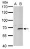 F-Box And Leucine Rich Repeat Protein 4 antibody, GTX115808, GeneTex, Western Blot image 