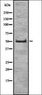 Interferon Alpha 2 antibody, orb335324, Biorbyt, Western Blot image 