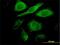 Cyclin Dependent Kinase 4 antibody, H00001019-M09, Novus Biologicals, Immunocytochemistry image 