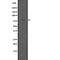 Protein Arginine Methyltransferase 7 antibody, abx217954, Abbexa, Western Blot image 