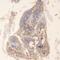 TNF Receptor Associated Factor 6 antibody, A00185, Boster Biological Technology, Immunohistochemistry paraffin image 