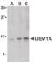 Ubiquitin Conjugating Enzyme E2 V1 antibody, PA5-20081, Invitrogen Antibodies, Western Blot image 