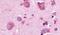 P2Y Receptor Family Member 8 antibody, PA5-34098, Invitrogen Antibodies, Immunohistochemistry paraffin image 