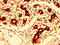 Fucosyltransferase 8 antibody, LS-C672579, Lifespan Biosciences, Immunohistochemistry paraffin image 