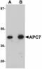 Anaphase Promoting Complex Subunit 7 antibody, LS-B4646, Lifespan Biosciences, Western Blot image 