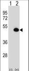 Argininosuccinate Synthase 1 antibody, LS-C156555, Lifespan Biosciences, Western Blot image 