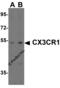 C-X3-C Motif Chemokine Receptor 1 antibody, 2093, ProSci, Western Blot image 