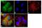 Erb-B2 Receptor Tyrosine Kinase 3 antibody, GTX19389, GeneTex, Immunofluorescence image 