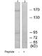 Mannose Receptor C Type 2 antibody, ab70132, Abcam, Western Blot image 