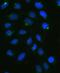 Protein Phosphatase 1 Regulatory Inhibitor Subunit 14A antibody, A05752-1, Boster Biological Technology, Immunofluorescence image 