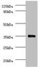 Protein Phosphatase 2 Catalytic Subunit Beta antibody, CSB-PA00985A0Rb, Cusabio, Western Blot image 