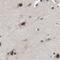 THO Complex 1 antibody, NBP1-89670, Novus Biologicals, Immunohistochemistry paraffin image 