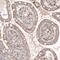 Granulin Precursor antibody, NBP2-61424, Novus Biologicals, Immunohistochemistry paraffin image 