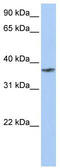 Transmembrane And Coiled-Coil Domain Family 1 antibody, TA335602, Origene, Western Blot image 