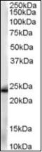 Glutathione S-Transferase Pi 1 antibody, orb88155, Biorbyt, Western Blot image 