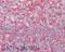 Phosphatidylinositol-4-Phosphate 5-Kinase Type 1 Alpha antibody, A07416, Boster Biological Technology, Immunohistochemistry paraffin image 