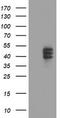 Carboxypeptidase O antibody, TA504750, Origene, Western Blot image 