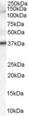 Cytochrome P450 Family 17 Subfamily A Member 1 antibody, 45-446, ProSci, Immunohistochemistry frozen image 