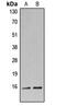 H3 Histone Family Member 3B antibody, MBS8206852, MyBioSource, Western Blot image 