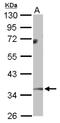 Monoglyceride Lipase antibody, NBP2-19380, Novus Biologicals, Western Blot image 